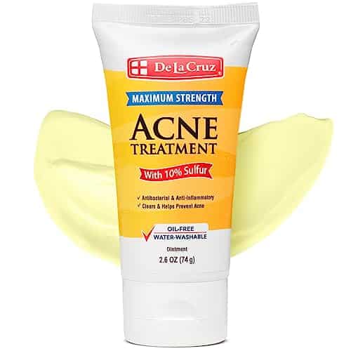 De La Cruz Sulfur Ointment   Cystic Acne Treatment   Cystic Acne Spot Treatment for Face and Body   OZ Tube